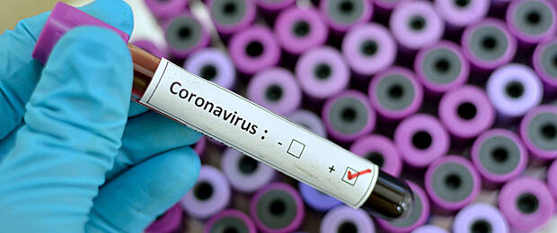 Laut einer aktuellen Bitkom-Umfrage erwartet jedes vierte Unternehmen aufgrund des Coronavirus negative Auswirkungen auf das eigene Geschäftsergebnis. (Bild: jarun011/iStock/Getty Images Plus)